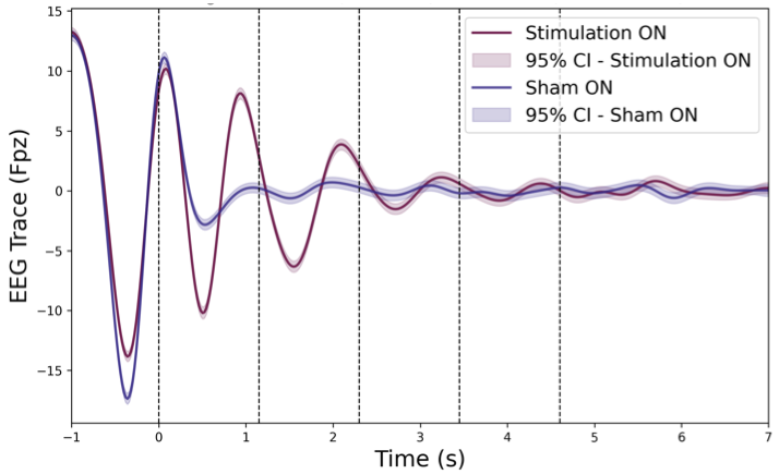 Average EEG waveforms showing enhanced slow-wave activity during auditory stimulation compared to sham