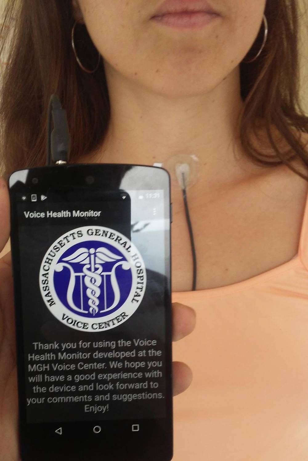 Ambulatory voice monitoring using neck surface acceleration